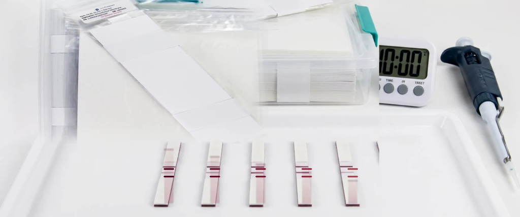 Lateral Flow test strips, sample tubes, timer, and pipette on a white lab surface for rapid diagnostic testing